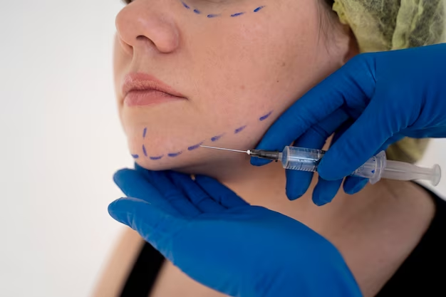 Normal bruising after fillers: what to expect and how much is typical